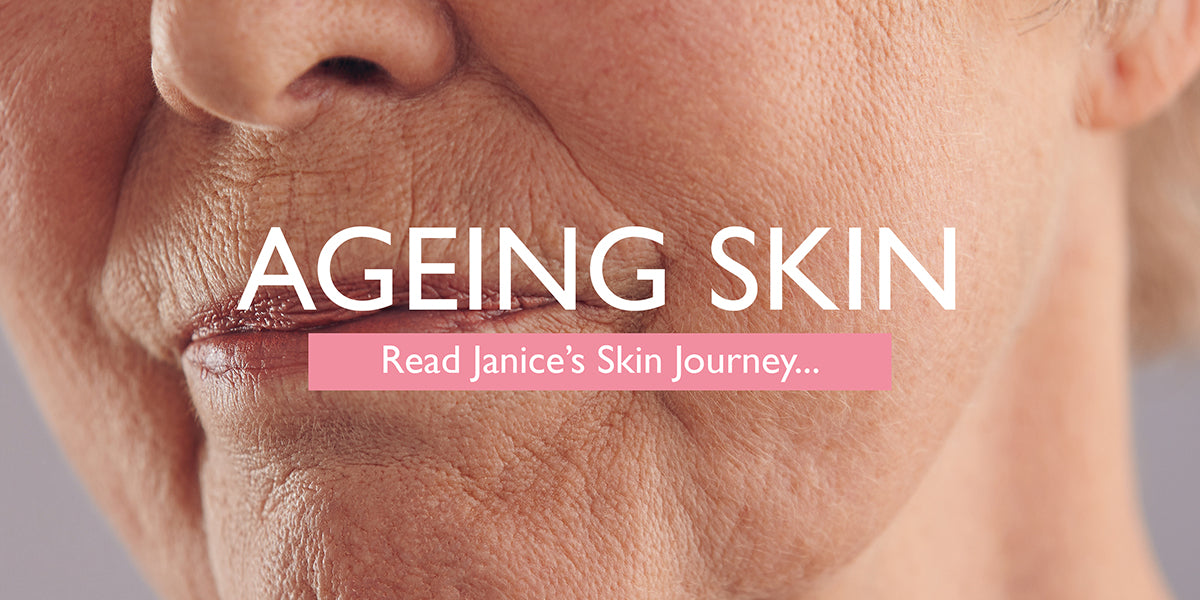 Janice’s Ageing Skin Journey to Happy, Healthy Skin  SKINICIAN