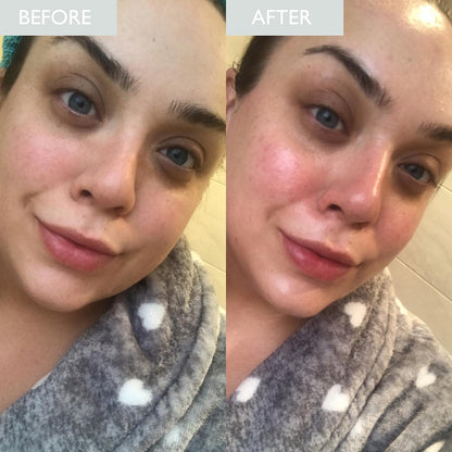 Image of customer's skin before and after using Pro-Radiance Enzyme Cleanser using an increase in skin luminosity